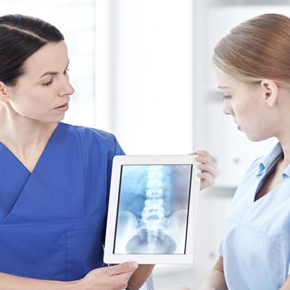 Two female medical professionals looking at spine x-ray