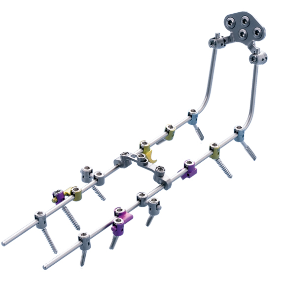 S4 Cervical Fixation System