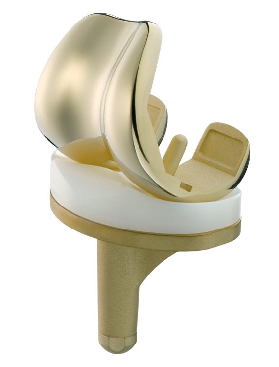 Columbus Knee System with Advanced Surface Technology