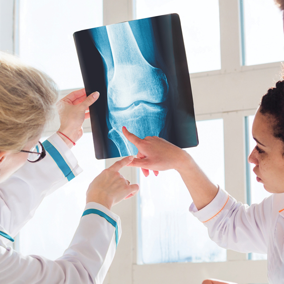 Two doctors examining knee xray